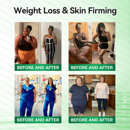 𝑶𝒇𝒇𝒊𝒄𝒊𝒂𝒍 𝑺𝒕𝒐𝒓𝒆  |🍀🍀𝐂𝐚𝐫𝐞𝐔𝐩𝐥𝐢𝐟𝐭® 𝑴𝒆𝒕𝒂𝒃𝒐𝒍𝒊𝒄 𝑵𝒂𝒏𝒐 𝑴𝒊𝒄𝒓𝒐𝒏𝒆𝒆𝒅𝒍𝒆 𝑷𝒂𝒕𝒄𝒉🇺🇸(𝐉𝐮𝐬𝐭 𝐨𝐧𝐜𝐞 𝐚 𝐝𝐚𝐲, 𝐯𝐢𝐬𝐢𝐛𝐥𝐞 𝐜𝐡𝐚𝐧𝐠𝐞𝐬 𝐢𝐧 𝟕 𝐝𝐚𝐲𝐬）𝘽𝙚𝙧𝙗𝙚𝙧𝙞𝙣𝙚 + 𝙈𝙤𝙧𝙞𝙣𝙜𝙖 𝙁𝙤𝙧𝙢𝙪𝙡𝙖 ✅ 𝐅𝐨𝐫 𝐨𝐛𝐞𝐬𝐢𝐭𝐲, 𝗟𝗼𝗼𝘀𝗲 𝘀𝗸𝗶𝗻,𝐝𝐢𝐚𝐛𝐞𝐭𝐞𝐬, 𝐬𝐥𝐞𝐞𝐩 𝐚𝐩𝐧𝐞𝐚, 𝐣𝐨𝐢𝐧𝐭 𝐢𝐬𝐬𝐮𝐞𝐬, 𝐚𝐧𝐝 𝐦𝐨𝐫𝐞💯💯