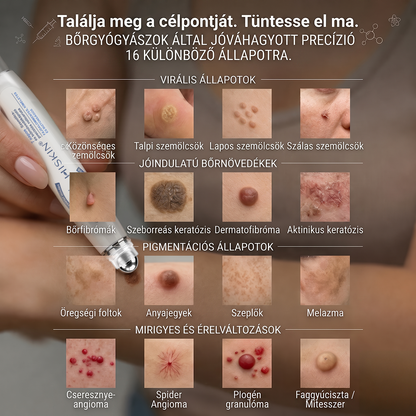 🎉 KORLÁTOZOTT IDEIG: 50% KEDVEZMÉNY 💎 Hivatalos Hiskin® üzlet | 7 napos bőrkinövés- és folteltávolító | Professzionális minőségű golyós applikátor | Fájdalommentes • Hegmentes • Arcra és testre is biztonságos